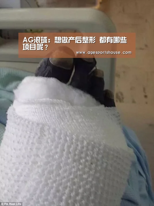 AG滚球:想做产后整形 都有哪些项目呢?(图2) AG竞猜