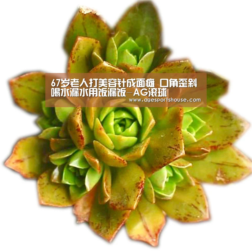 67岁老人打美容针成面瘫 口角歪斜喝水漏水用饭漏饭-AG滚球(图2) AG视讯
